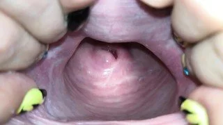 Stunning Cervix Close-Up in 4K Resolution – Intimate Exploration